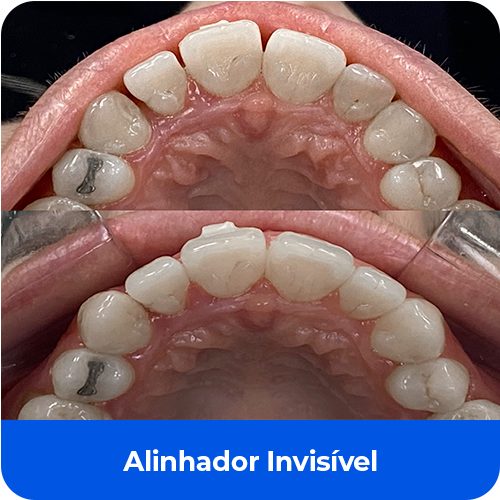 Cartão Informativo