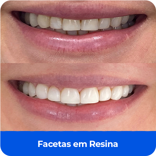 Cartão Informativo