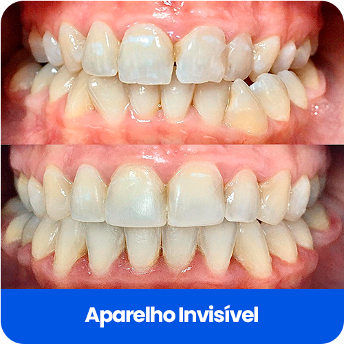 Cartão Informativo