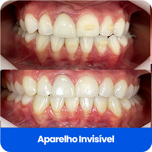 Cartão Informativo