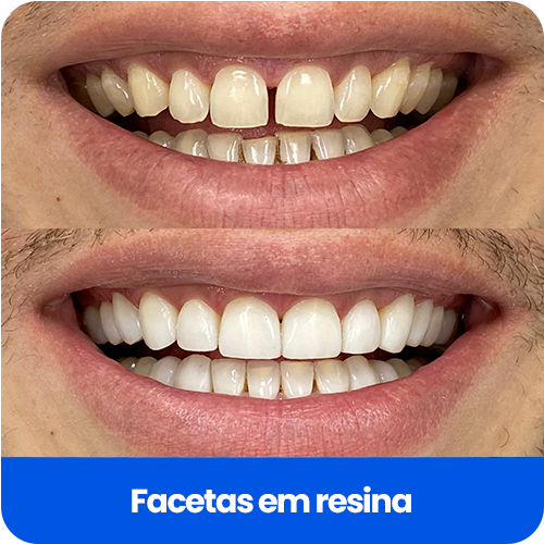 Cartão Informativo
