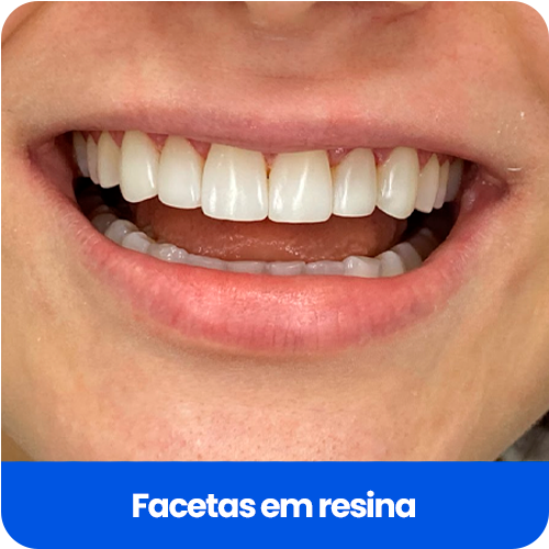 Cartão Informativo